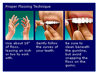 Flossing